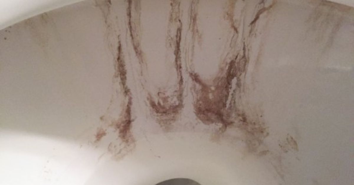 How do you clean a badly stained toilet bowl?