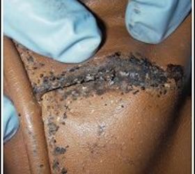 bed bugs facts and info, pest control, leather couch under the arm bad infestation