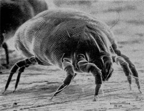 how to get rid of dust mites, cleaning tips, how to, pest control