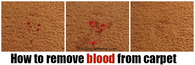 how to remove blood stains from furniture carpeting and clothing, cleaning tips, reupholster