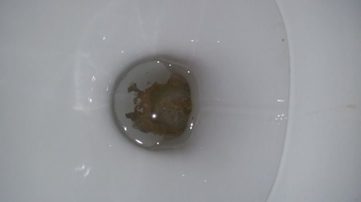 The Bottom Of My Toilet Looks Grey How Do I Get Rid Of It Hometalk