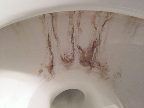 removing nasty toilet stains, bathroom ideas, cleaning tips