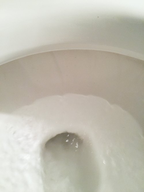 removing nasty toilet stains