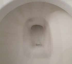 discharge looks like pieces of toilet paper