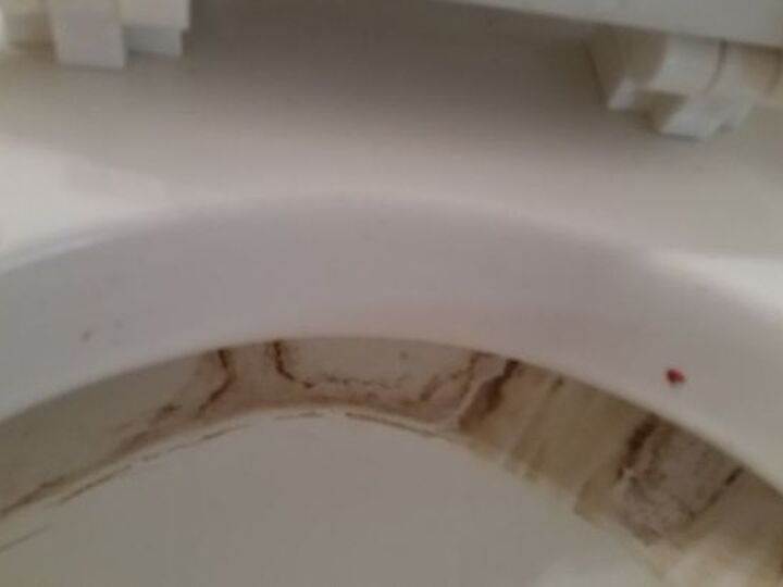 q clean a toilet someone has used it for a ashtray stained badly