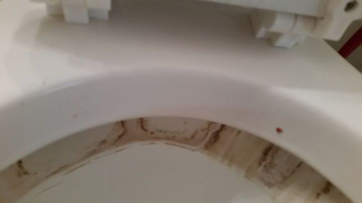 q clean a toilet someone has used it for a ashtray stained badly