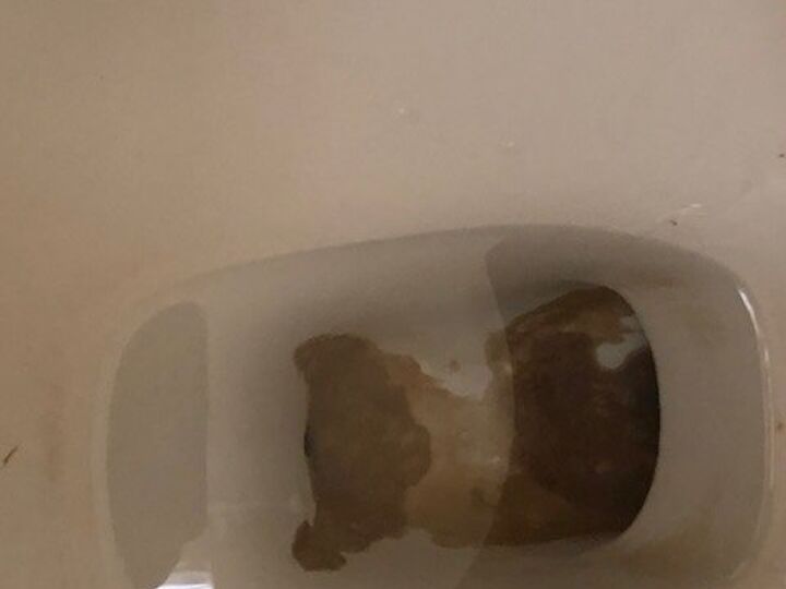 q how to we get rid of this stain