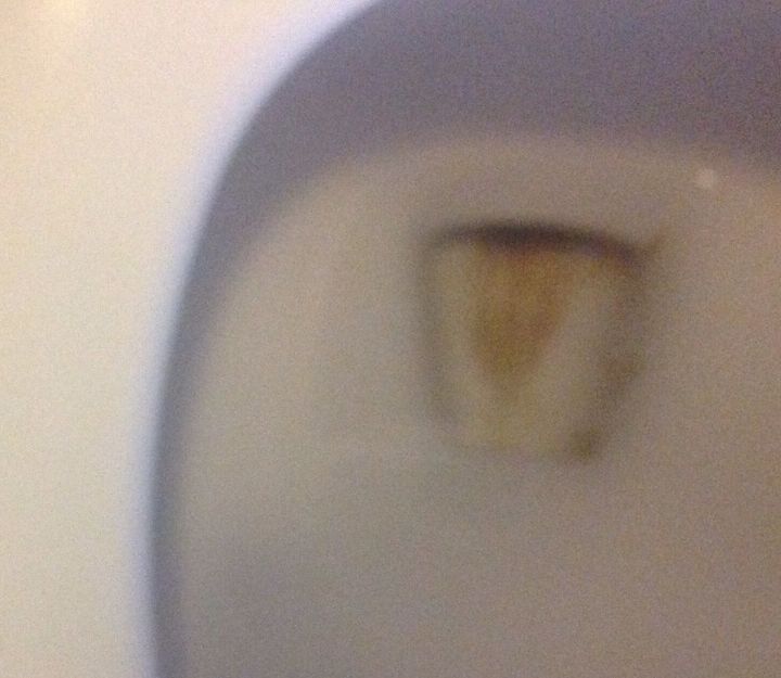 how do i remove a brown toilet bowl stain