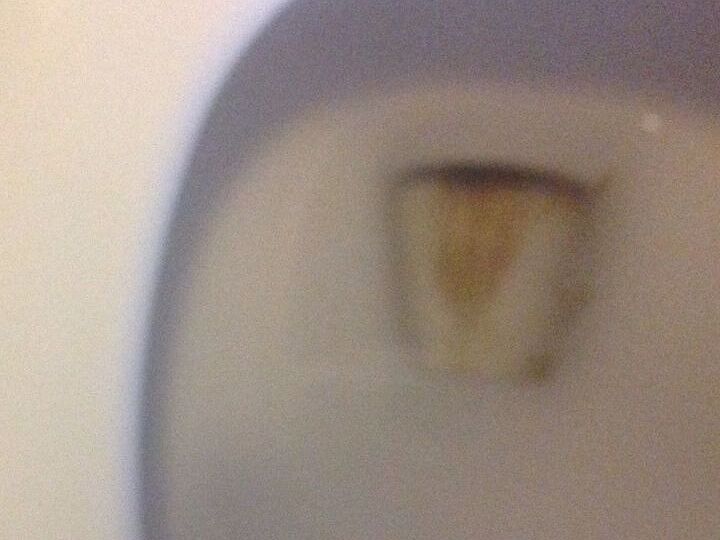 q remove brown toilet bowl stain