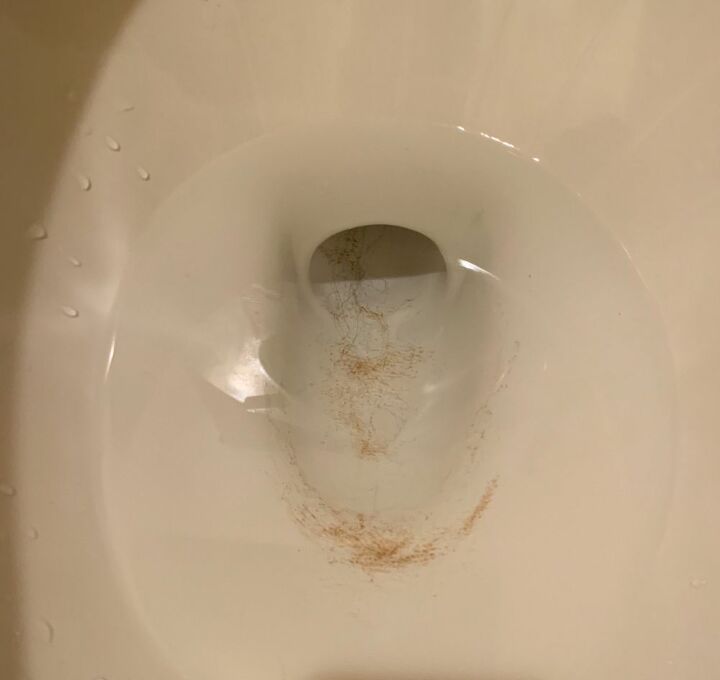 how do i remove this in my toilet