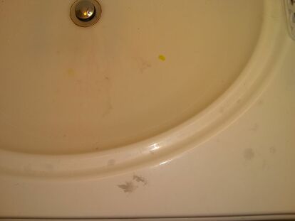 How Can I Remove Hair Dye Stains From A, Hair Dye Bathtub Stain Removal