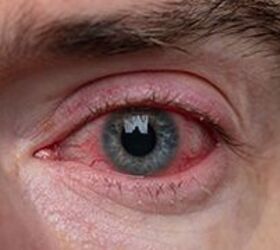 Are you wasting your money on eye drops?