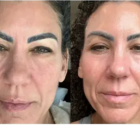 At 61, She Says Her Skin Looks Younger Than It Did 10 Years Ago