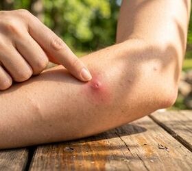 We Thought Mosquitoes at Backyard BBQ's Were Just Part of Summer