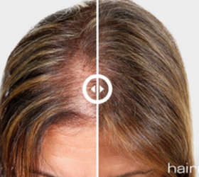 Real Science. Real Hair Growth.