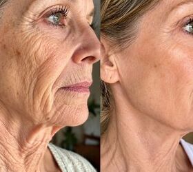 Dermatologists Stunned: 1 Korean Gelatin Teaspoon Erases 20 Years Of Aging
