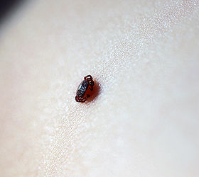 quick and easy tick removal, pets animals, Step 1 Locate Tick A simple visual inspection at the end of the day